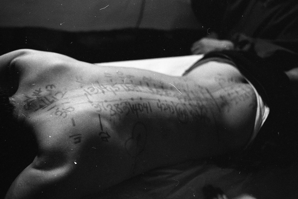 A black and white photograph of a person lying shirtless and face down on a table. Along their exposed spine are various markings, including lines, dots, and numbers.&nbsp;