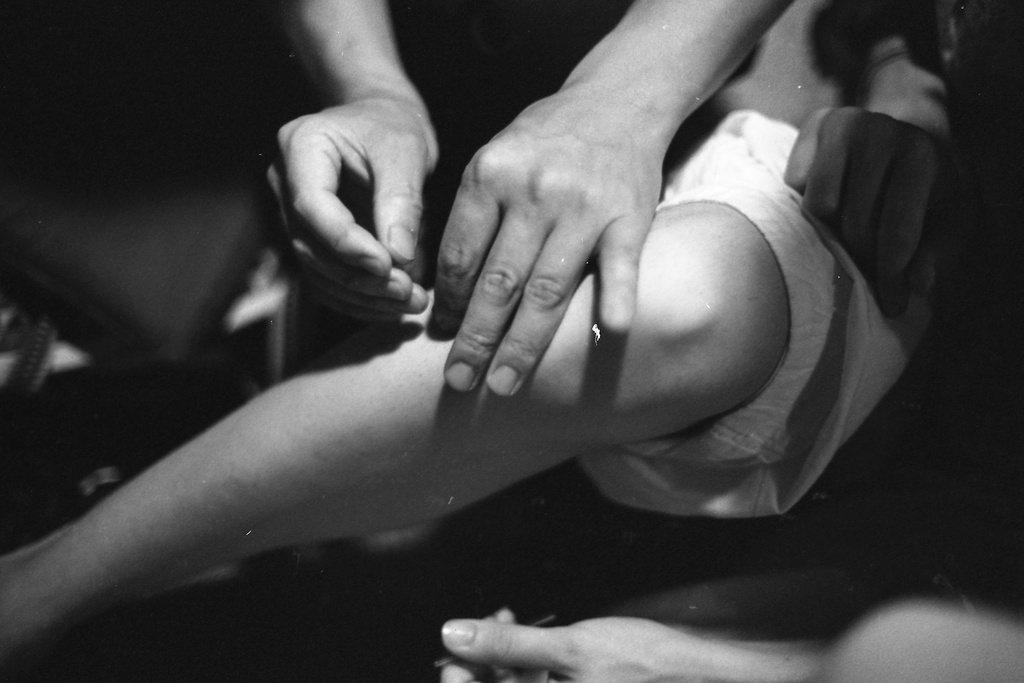 A black and white photograph of an acupuncture session. Two hands in the top of the frame gently insert a needle into the extended arm of a person in the center of the image.&nbsp;